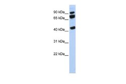 DDX17 Antibody, Novus Biologicals 100 &mu;L; Unconjugated:Antibodies, Polyclonal